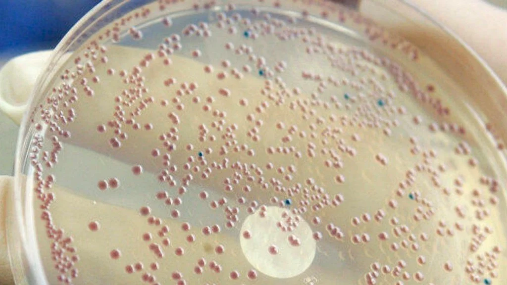 ISO 21150 - Kozmetiklerde Escherichia coli Tespiti Testi