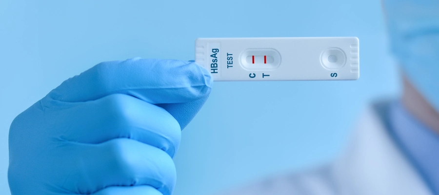Hepatit B Yüzey Antijeni (HBsAg) Testi