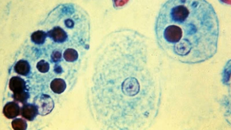 Entamoeba Histolytica Antijen Testi