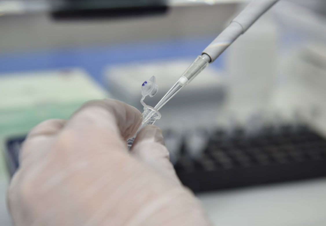 Polymerase Chain Reaction (PCR) Testi