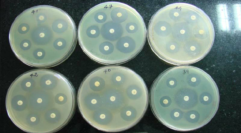 E-test Antibiyotik Duyarlılık Testi