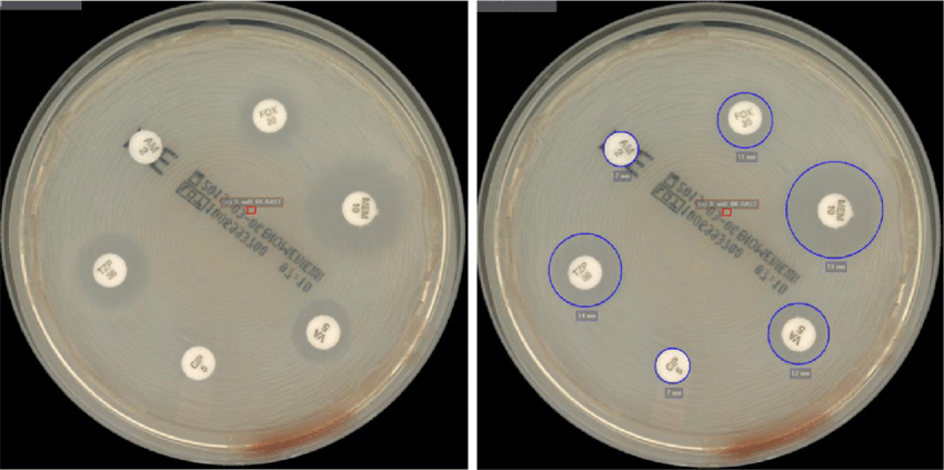 MRSA Tespiti (Methicillin Resistance) Testi