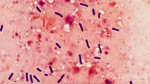 Clostridium perfringens Tespiti Testi