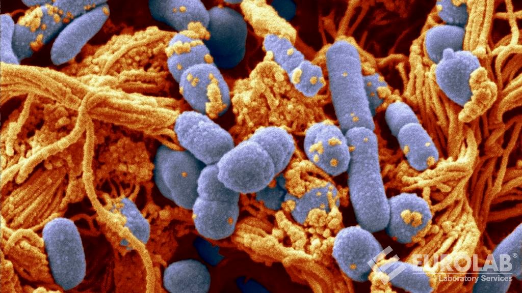 ISO 6579-1 - Gıda Ürünlerinde Salmonella spp. Tespiti