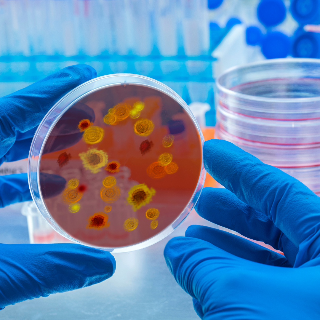 ISO 13408-1 - Aseptik İşlemlerde Biyolojik Kontaminasyon Kontrolü
